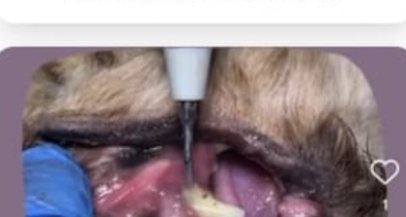 Limpieza dental